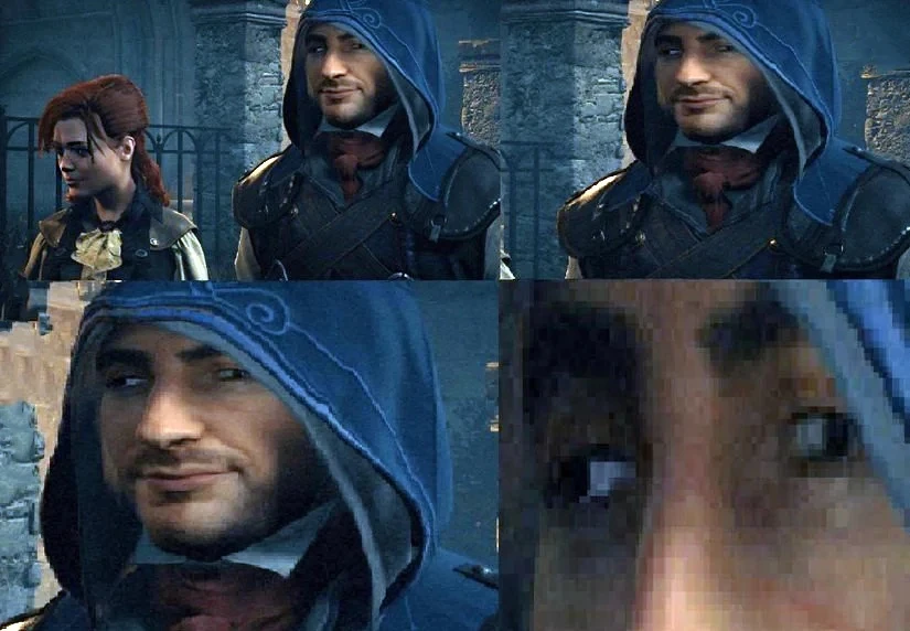 Косоглазие