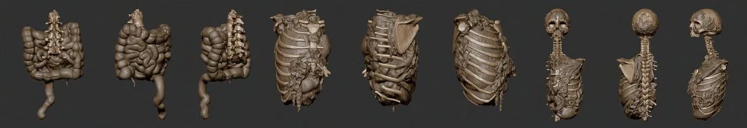 Killing Floor 2 - Игровая механика - Расчлененка