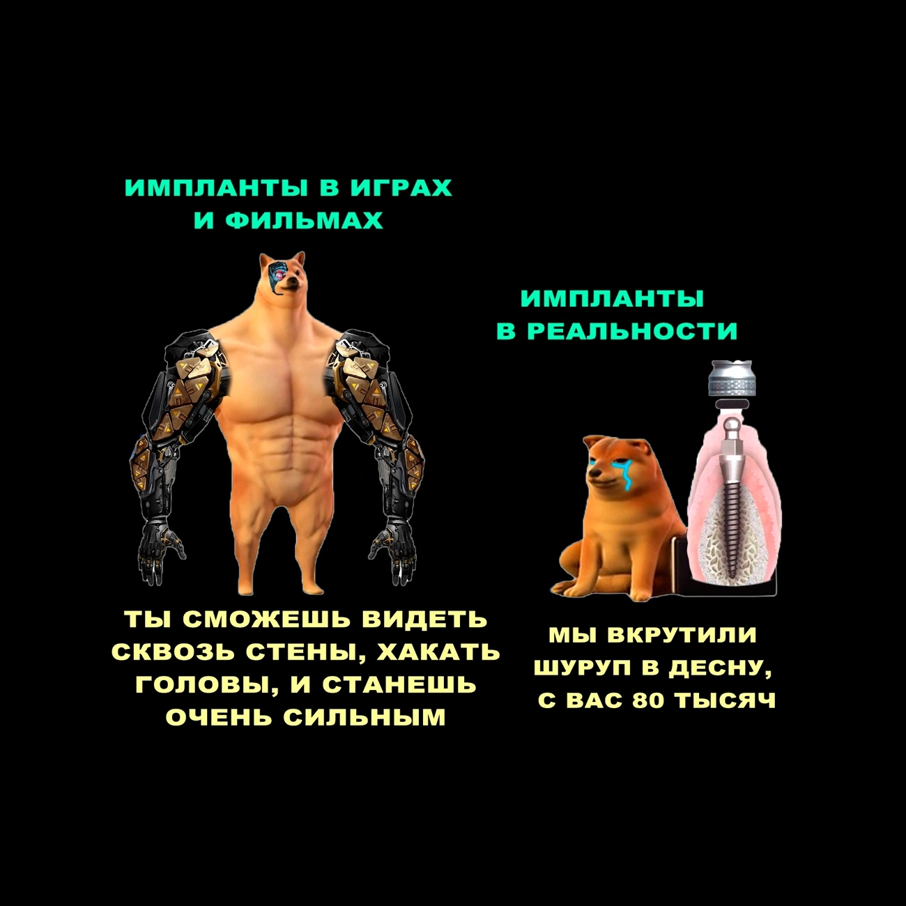 Импланты